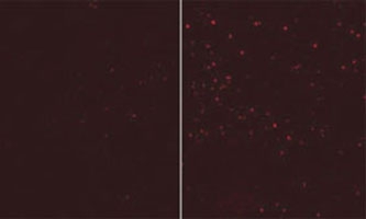 ATG12 antibody tested in 293 cells, fixed in PFA permeablilized with 0.2% Saponin, blocked with 10% goat serum. Secondary was mouse 555. The right is in full medium (FM) and the left with EBSS (no Leupeptin) (Provided by Nicole McKnight & Sharon Tooze).