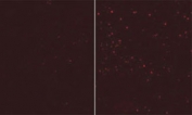ATG12 antibody tested in 293 cells, fixed in PFA permeablilized with 0.2% Saponin, blocked with 10% goat serum. Secondary was mouse 555. The right is in full medium (FM) and the left with EBSS (no Leupeptin) (Provided by Nicole McKnight & Sharon Tooze).