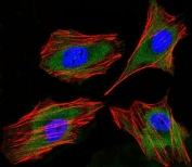Immunofluorescent staining of fixed and permeabilized human HeLa cells with LTF antibody (green), DAPI nuclear stain (blue) and anti-Actin (red).