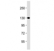 Western blot testing of human HepG2 cell lysate with ITGA6 antibody. Predicted molecular weight ~127 kDa.