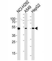 Western blot analysis of lysate from NCI-H292, A549, HepG2 cell line (left to right) using ALDH2 antibody at 1:1000 for each lane.