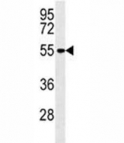 MMP14 antibody western blot analysis in A2058 lysate. Predicted molecular weight: ~66/54kDa.
