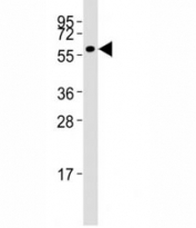 Western blot testing of MMP14 antibody at 1:1000 dilution + HT-1080 lysate; Predicted molecular weight: ~66/54kDa.