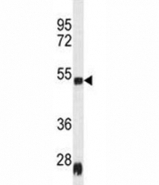 Western blot analysis of Serpinh1 antibody and rat heart tissue lysate; Ab used at 1:100.