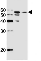 Western blot analysis of lysate from MCF-7, T47D cell line (left to right) using ALDH6A1 antibody at 1:1000 for each lane.