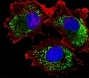 Fluorescent image of MCF-7 cells stained with ALDH6A1 antibody; Ab was diluted at 1:25 dilution. An Alexa Fluor 488 secondary Ab (green); DAPI counterstain (blue). Cytoplasmic actin was counterstained with Alexa Fluor 555 conjugated with Phalloidin (red).