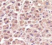 Immunohistochemical analysis of paraffin-embedded human liver section using ALDH6A1 antibody at 1:25 dilution.