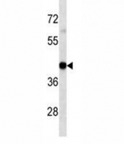 HLA-A antibody western blot analysis in mouse liver tissue lysate. Expected/observed molecular weight ~41kDa.