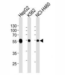Western blot analysis of lysate from HepG2, K562, NCI-H460 cell line using ALDH1A1 antibody at 1:1000 for each lane.