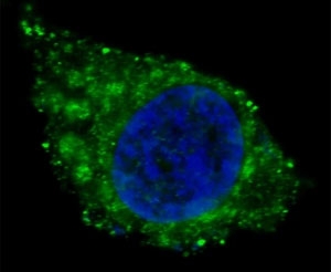 Fluorescent confocal image of HepG2 cells stained with ALDH1A1 antibody. ALDH1A1 immunoreactivity is localized to the cytoplasm.
