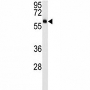 AKT3 western blot analysis in mouse NIH3T3 lysate (15ug/lane). Predicted molecular weight: ~56kDa but can be observed from 60~65kDa.
