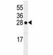 EIF4E antibody western blot analysis in HeLa lysate. Predicted molecular weight ~27 kDa.