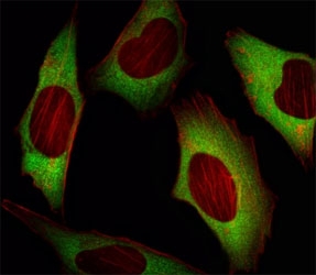 Fluorescent image of HeLa cell stained with EIF4E antibody. EIF4E immunoreactivity is localized to the cytoplasm.~