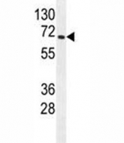 S6K2 antibody western blot analysis in mouse heart tissue lysate. Predicted molecular weight: 60-70 kDa