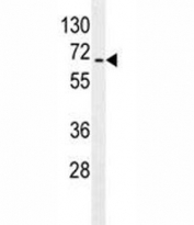 S6K2 antibody western blot analysis in Jurkat lysate