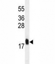 MCFD2 antibody western blot analysis in U251 lysate.