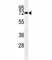 LIMK1 antibody western blot analysis in mouse brain tissue lysate. Expected molecular weight ~72 kDa.