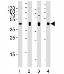 Western blot analysis of lysate from 1) human skeletal muscle, 2) human brain, 3) mouse brain, and 4) rat brain tissue using PDK2 antibody at 1:2000 for each lane.~