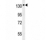 NTRK1 antibody western blot analysis in mouse brain tissue lysate. Expected molecular weight: 85~140 kDa depending on glycosylation level.