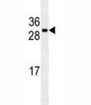 CDCA8 antibody western blot analysis in U251 lysate
