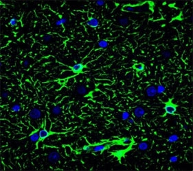 Confocal immunofluorescent analysis of GFAP antibody with brain tissue followed by Alexa Fluor 488-conjugated goat anti-mouse lgG (green). DAPI was used as a nuclear counterstain (blue).