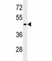 GFAP antibody western blot analysis in MCF-7 lysate. Predicted molecular weight: ~50kDa.