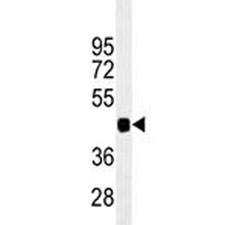PAX6 antibody western blot analysis in 293 lysate