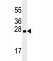 LXN antibody western blot analysis in mouse brain tissue lysate. Predicted molecular weight: 26kDa.