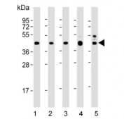 Western blot testing of human 1) CCRF-CEM, 2) HEK293, 3) HepG2, 4) mouse heart and 5) rat heart lysate with VEGFC antibody. Predicted molecular weight ~45 kDa.