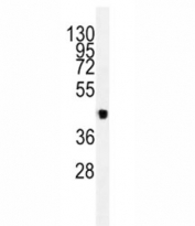 Western blot analysis of lysate from 293 cells using VEGFC antibody. Predicted molecular weight ~45 kDa.