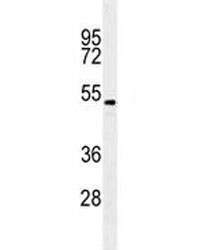 TGFB2 antibody western blot analysis in A549 lysate. Predicted molecular weight ~50 kDa