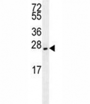 EIF4E2 antibody western blot analysis in NCI-H460 lysate. Predicted molecular weight: ~28 kDa.