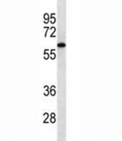 CAMKK2 western blot analysis in Jurkat lysate. Predicted molecular weight 60-65 kDa.