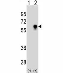 Western blot analysis of CDC25C antibody and 293 cell lysate (2 ug/lane) either nontransfected (Lane 1) or transiently transfected (2) with the CDC25C gene.