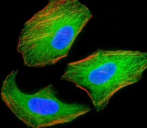 Fluorescent image of HeLa cells stained with TSC2 antibody. Alexa Fluor 488 secondary (green), cytoplasmic actin (red) and nuclei counterstained with DAPI (blue) were used. TSC2 immunoreactivity is localized to the microtubules.~