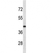 LHX2 antibody western blot analysis in MDA-MB435 lysate. Predicted molecular weight ~44kDa.