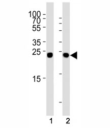 Western blot analysis of lysate from (1) HT29 and (2) HepG2 cell line using Glucagon antibody at 1:1000. Predicted molecular weight ~21 kDa.