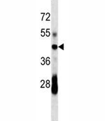 CD79a antibody western blot analysis in mouse spleen tissue lysate. Predicted/Observed molecular weight: 25~47 kDa depending on glycosylation level