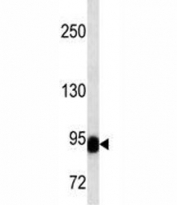 BCL-6 antibody western blot analysis in NCI-H292 lysate. Predicted molecular weight: 78~100 kDa.