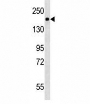 PDGFR antibody western blot analysis in mouse NIH3T3 lysate. Expected molecular weight: 123-190 kDa depending on level of glycosylation.