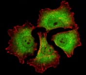 Fluorescent image of A549 cells stained with UchL1 antibody at 1:25 dilution. An Alexa Fluor 488-conjugated goat anti-mouse lgG was used as the secondary Ab (green). Cytoplasmic actin was counterstained with Alexa Fluor 555 conjugated with Phalloidin (red).