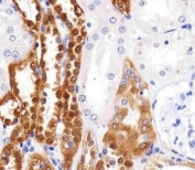 Immunohistochemical analysis of paraffin-embedded human kidney using UchL1 at 1:25 dilution.
