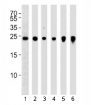 Western blot analysis of lysate from 1) NCI-H460, 2) U266, 3) mouse Neuro-2a, rat 4) PC-12 and 5) C6 cell line and 6) mouse brain tissue using UchL1 antibody at 1:1000. Predicted molecular weight ~25 kDa.