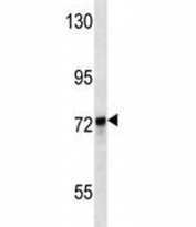 KEAP1 antibody western blot analysis in MDA-MB231 lysate. Predicted molecular weight ~70 kDa.