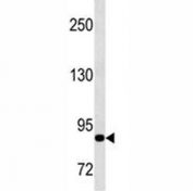 MMP9 antibody western blot analysis in CEM lysate. Predicted molecular weight: 92/67-80 kDa (precursor/mature forms).