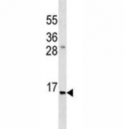 Anti-Insulin antibody western blot analysis in ZR-75-1 lysate.