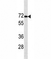Estrogen Receptor alpha antibody western blot analysis in MCF-7 lysate. Predicted molecular weight: 65-70 kDa.