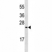 MUC1 antibody western blot analysis in MDA-MB435 lysate. This Ab will detect the 23-29 kDa isoforms of MUC1.