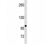 CD43 antibody western blot analysis in SK-BR-3 lysate. Predicted molecular weight 45-115 kDa depending on glycosylation level.