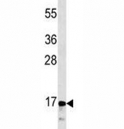 CGRP antibody western blot analysis in CEM lysate